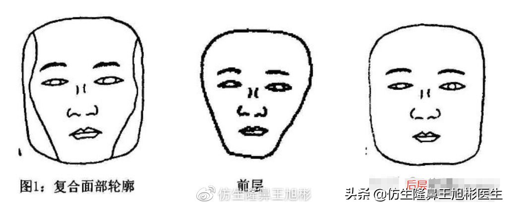 鼻整形后鼻头大,鼻整形后脸小了