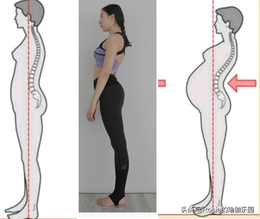 真翘臀和假翘臀怎么辨别,翘臀本来就有点骨盆前倾吗