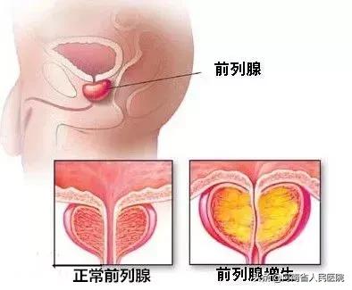 难言之隐1-40集完全版合集,难言之隐第十集完全版