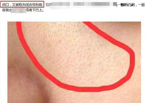 你知道什么是闭口吗,闭口和不是闭口