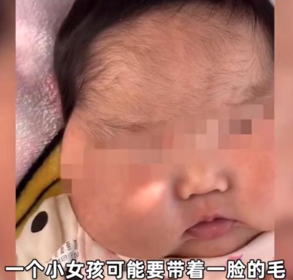 大头娃娃面霜事件官方回应,激素面霜大头娃娃现在怎样了