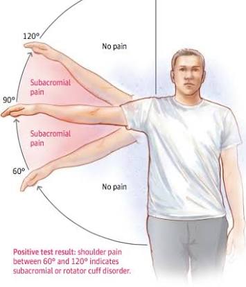 肩膀疼痛竟是如此大问题不可小觑,肩膀疼痛的辨别和解决方法