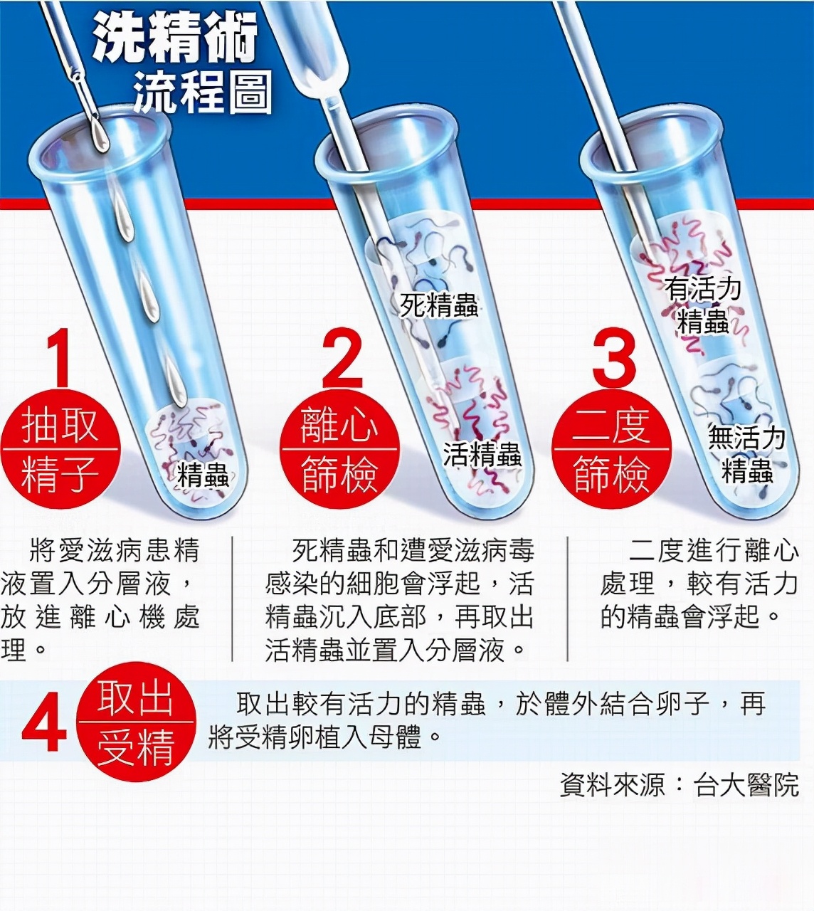 看呆医生：一次告捷！医院人工授精太贵，英女子购买针筒自行操作