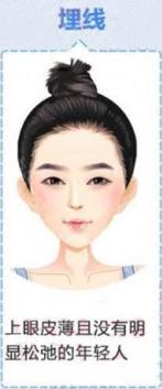 割完双眼皮不忌嘴会怎样,全切双眼皮疤痕增生期是什么时候