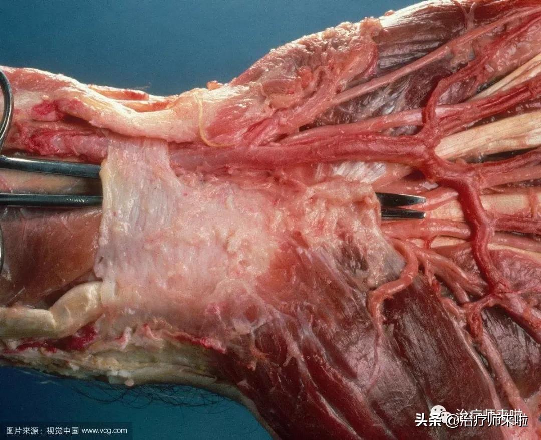 腕管综合征严重了能够不做手术吗,腕管综合征不治疗能养好吗