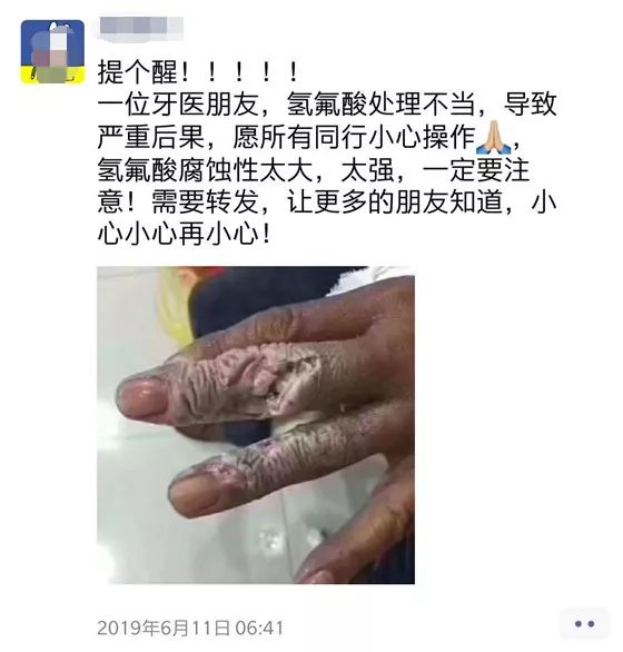 氢氟酸的危害有多可怕,氢氟酸的危害到底有多大