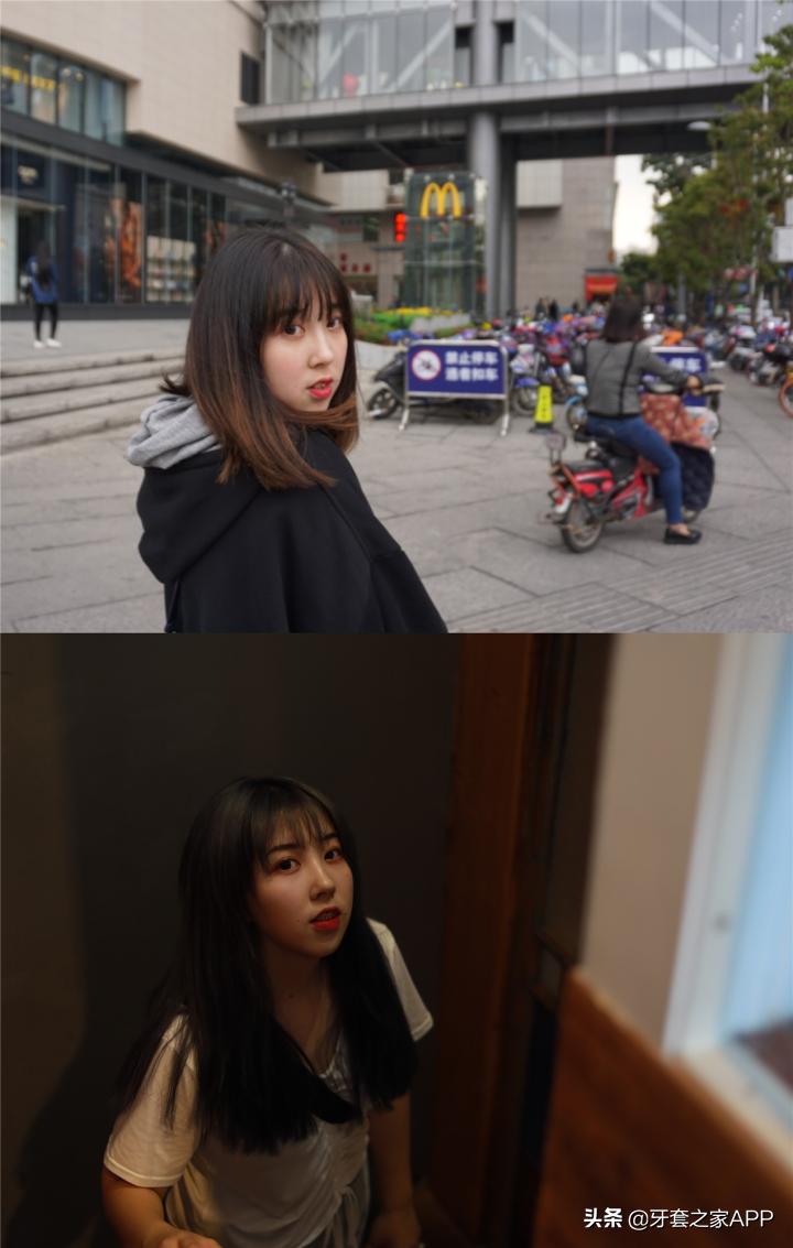 不靠整容怎么改变下巴后缩？看这里