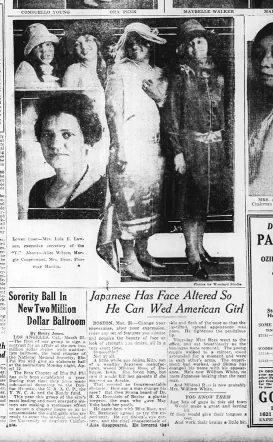 双眼皮真的有那么漂亮吗,自然双眼皮和割的双眼皮内在区别