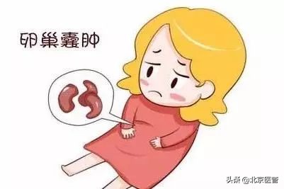 卵巢囊肿血清ca125高多少会癌变,绝经卵巢囊肿癌变的10个征兆