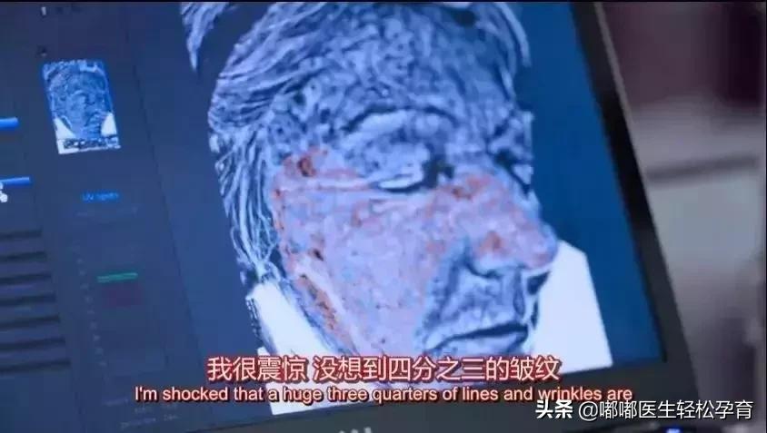 褪黑素和葡萄籽效果,葡萄籽褪黑素的功效和副功能