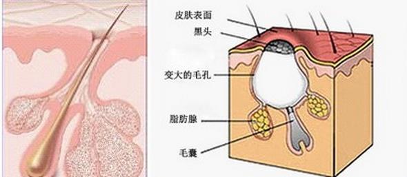 打败毛孔！下一个反孔精英就是你！