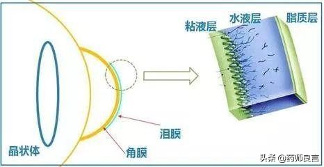 干眼症与睑板腺功能障碍的区别,干眼症跟睑板腺有哪些区别