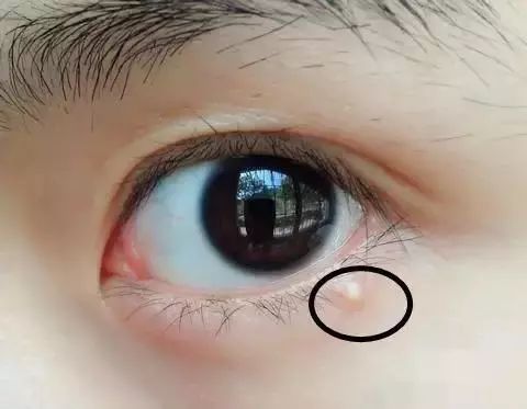 娑傜溂闇滄墜娉曚笉瀵瑰啀璐电溂闇滈兘鐧借垂,娑傜溂闇滄墜娉曚笉瀵瑰氨瀹屼簡