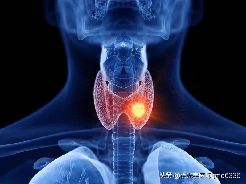 甲状腺结节是中医好还是西医好,甲状腺结节西医好还是中医好
