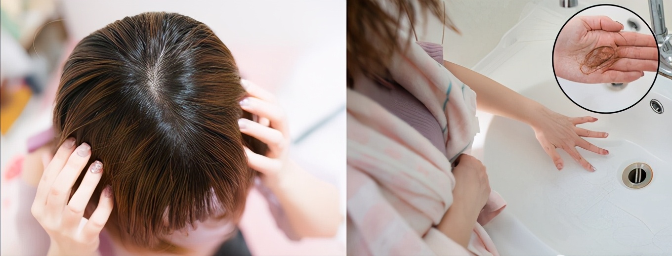 防脱固发洗发水真实推荐测评,防脱固发洗发水真实测评第一名