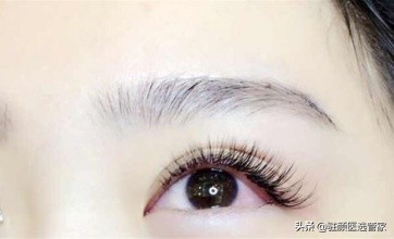 十个关于双眼皮的真相,关于双眼皮有哪些误区