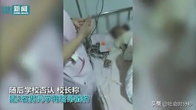 8岁女孩放学回家一身血，竟遭两男同学殴打*体下**，可能终生不孕……