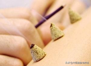 小儿艾灸有效果,小儿艾灸肚脐的好处与功效