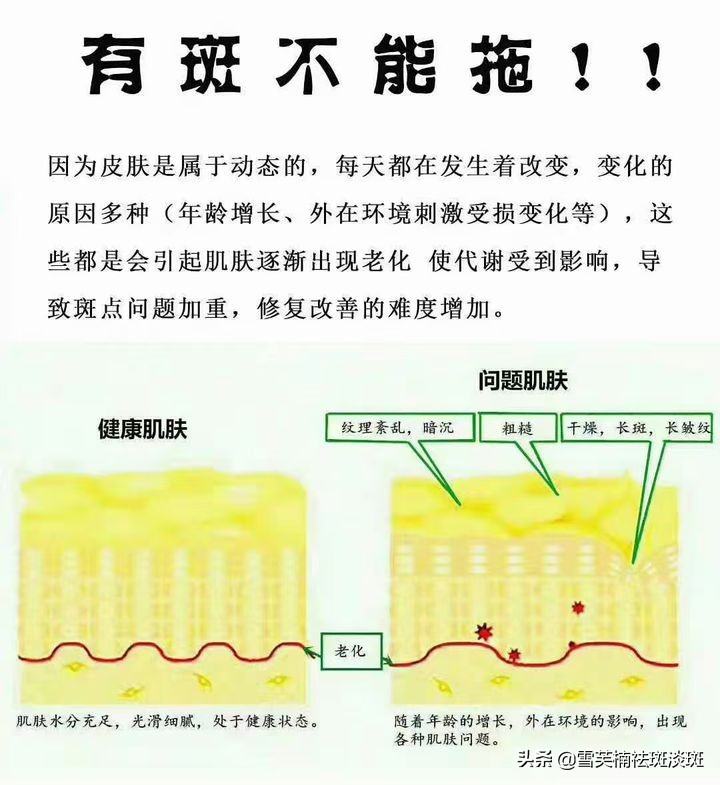 怎样能祛斑小妙招,祛斑小妙方教你有效祛斑的妙招