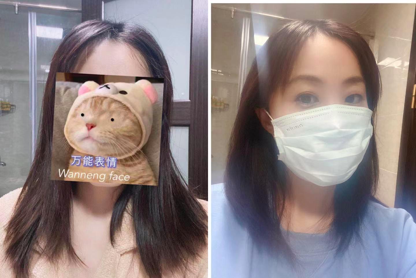 小宝宝脱发严重怎么办,拯救脱发小宝贝