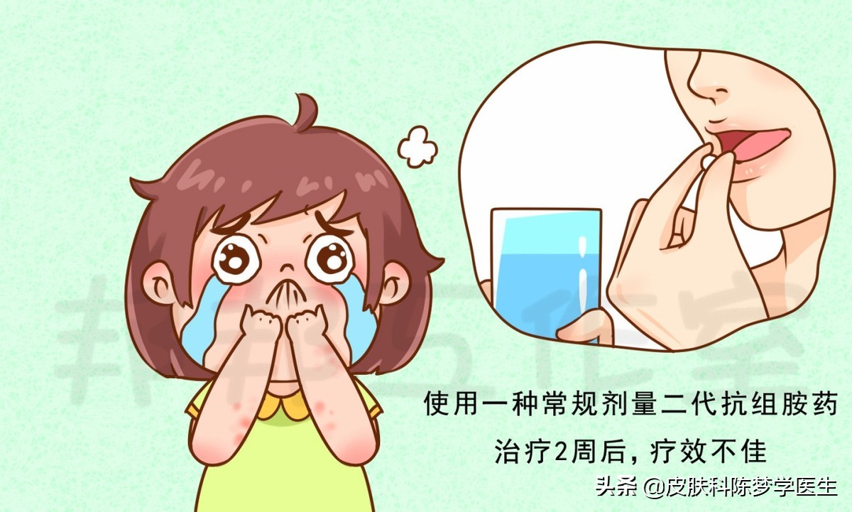 荨麻疹得了一年还能够治好吗,慢性荨麻疹治不好有什么后果