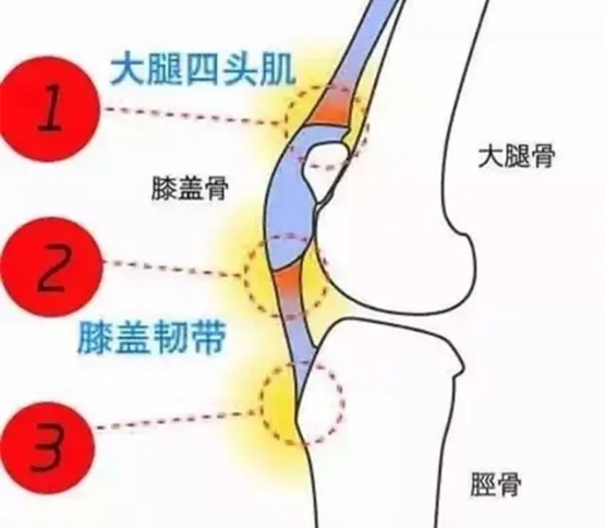 孩子膝盖内侧韧带损伤,儿童膝盖韧带损伤怎么治疗