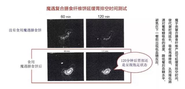 特医特膳功能食品规划,特医食品有哪些上市公司