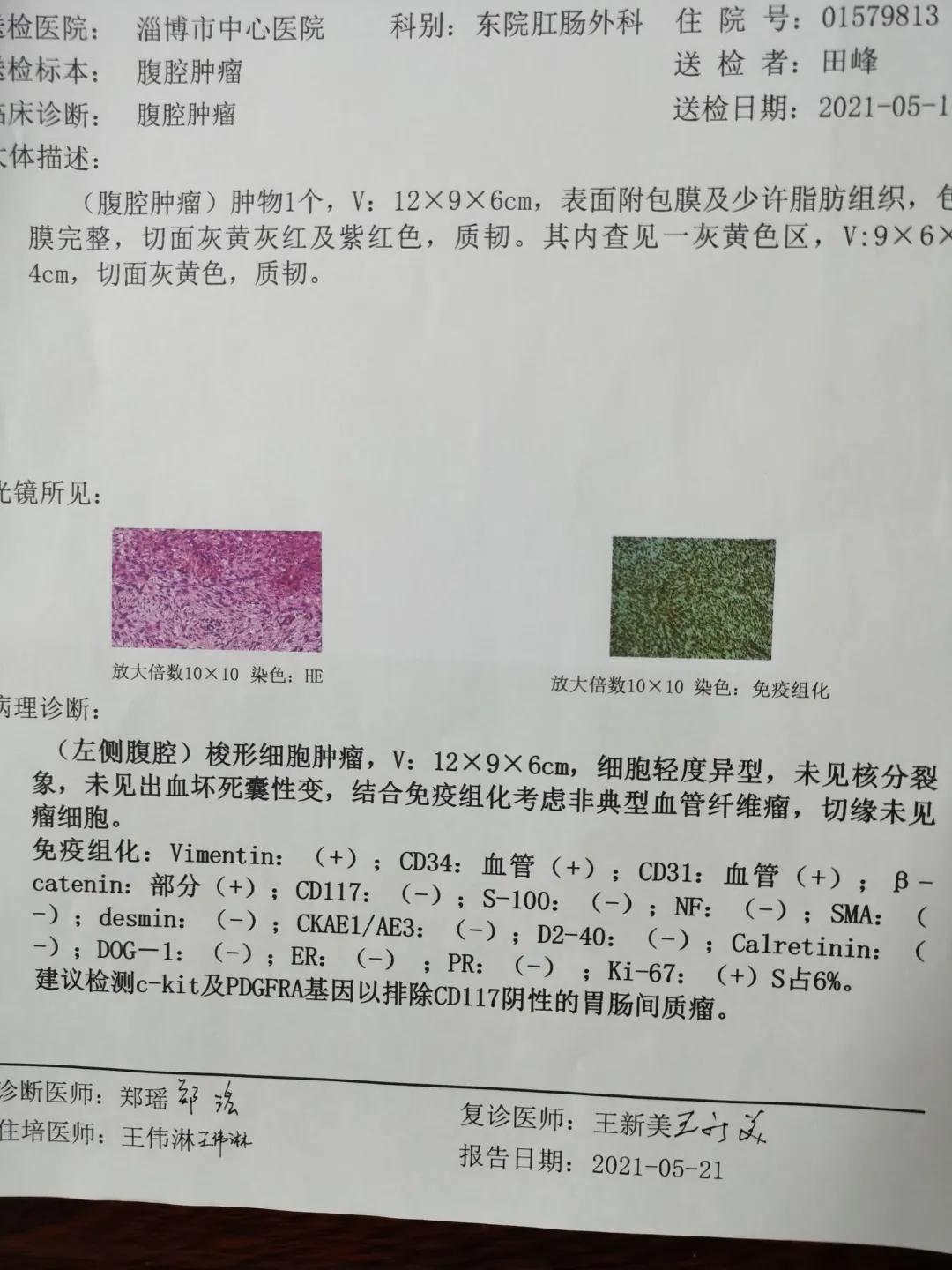 微创手术切除肠道肿瘤,中心医院切胃手术