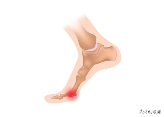 跑鞋如何挑选合适的码数,跑步买跑鞋要合脚还是要大一个码