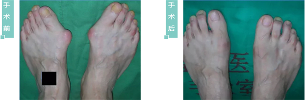 修足怎么才能修光滑,修足适履