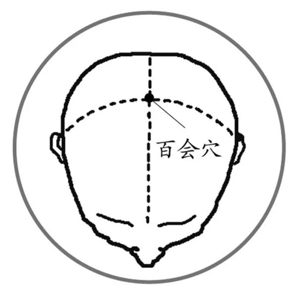 入睡难总做梦,入睡难梦多易醒有什么办法治愈