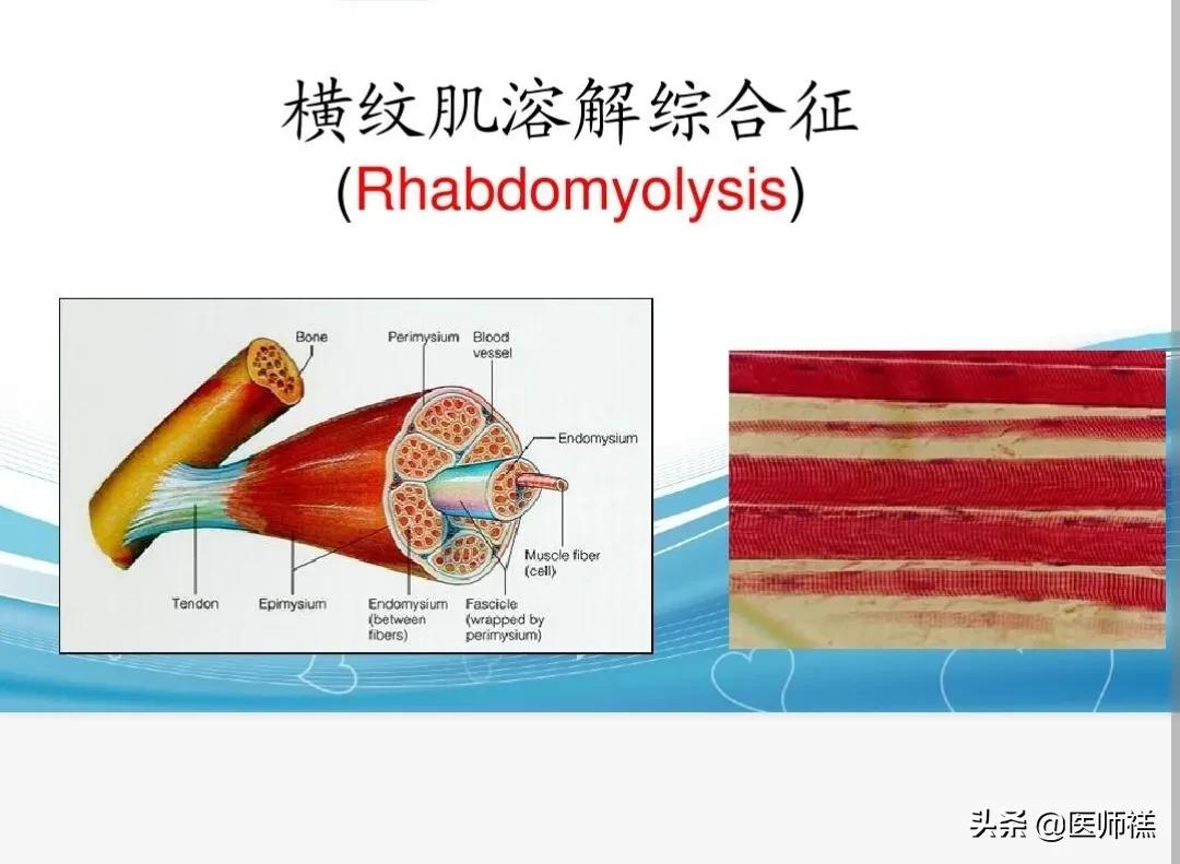 长期吃阿托伐他汀应该注意什么,长期服用阿托伐他汀会有什么后果
