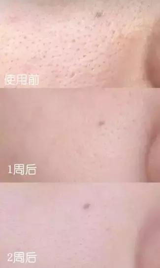 在家就能做的面部spa,在家能够做脸部spa吗