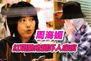 34岁男子不喝酒却因癌症去世,29岁小伙患上不死癌症